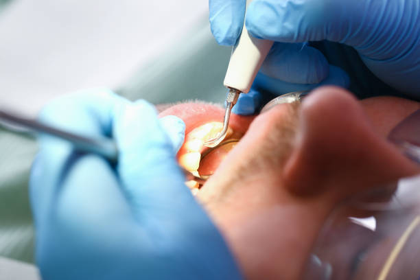 Best Emergency Treatment for Oral Infections in Tigerville, SC