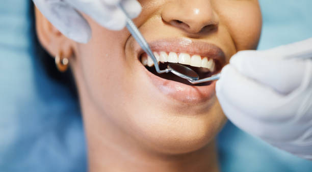 Best Emergency Dental Care for Sports Injuries in Tigerville, SC